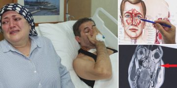 Diş ağrısı sanıp hastaneye gitti: Gerçeği öğrenince dehşete düştü! Bir ay daha geç kalsaydı…